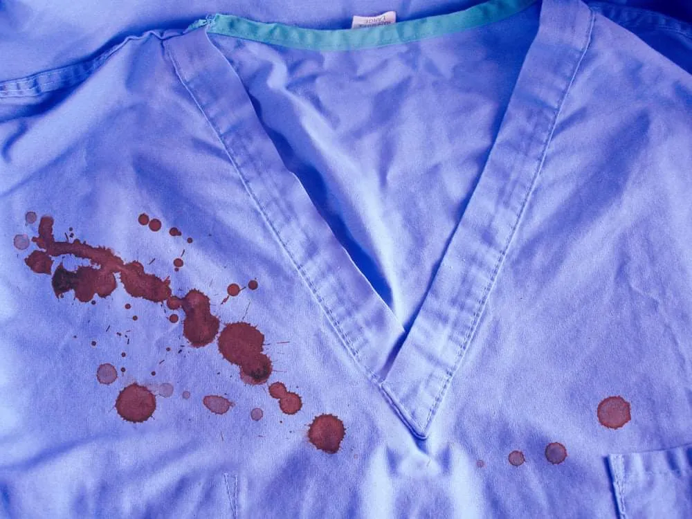 Pasta Lekesi: Temizlemenin En İyi Yolları